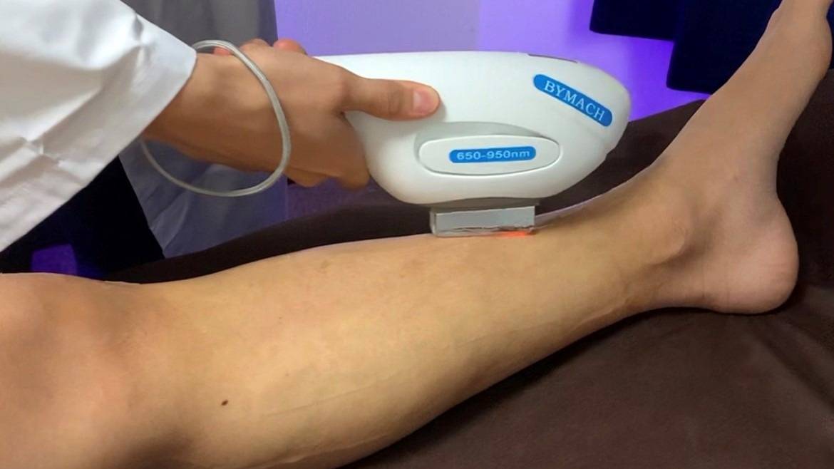 ツルツル美脚に! 足脱毛